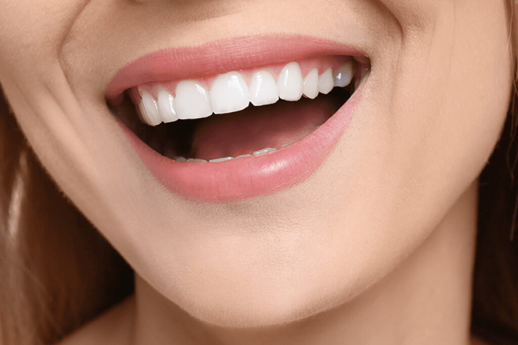 Hollywood Smile en Turquie