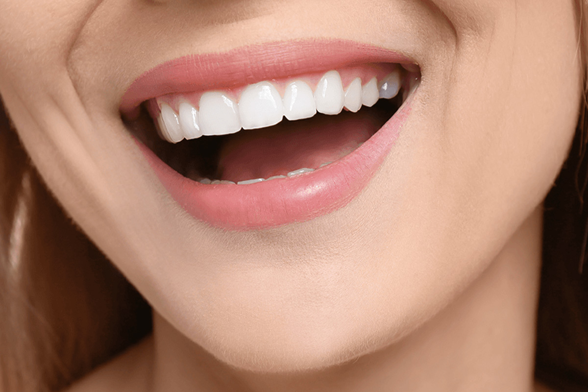 Hollywood Smile en Turquie